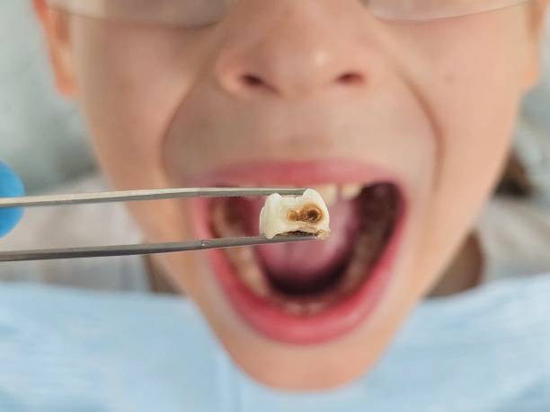 Best Cracked Tooth Emergency Dentist  in Russell Springs, KY